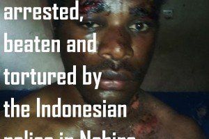 West Papuan youth tortured by the Indonesian police in Nabire