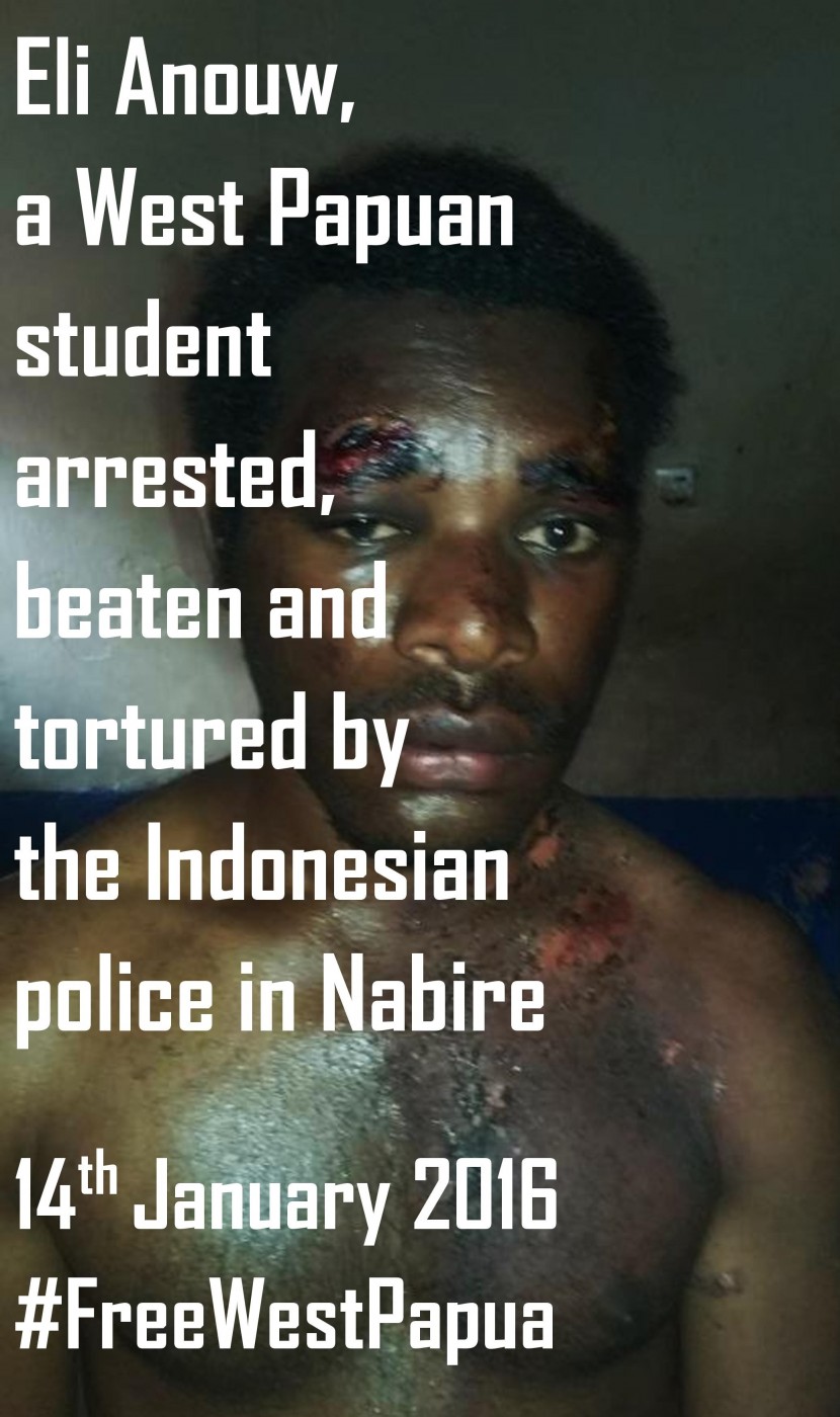 West Papuan youth tortured by the Indonesian police in Nabire